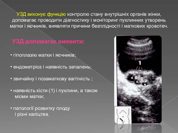 УЗД виконує функцію контролю стану внутрішніх органів жінки, допомагає проводити діагностику і