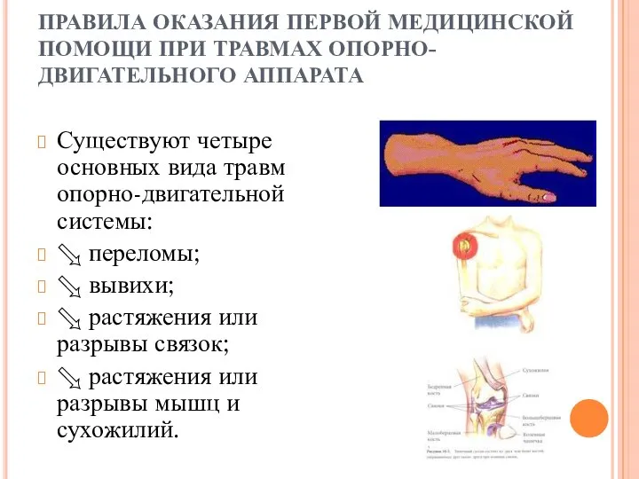 ПРАВИЛА ОКАЗАНИЯ ПЕРВОЙ МЕДИЦИНСКОЙ ПОМОЩИ ПРИ ТРАВМАХ ОПОРНО-ДВИГАТЕЛЬНОГО АППАРАТА Существуют четыре основных