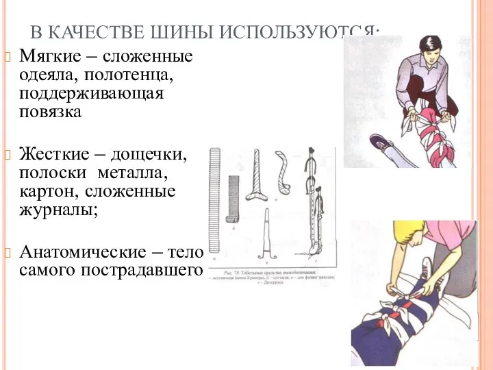 В КАЧЕСТВЕ ШИНЫ ИСПОЛЬЗУЮТСЯ: Мягкие – сложенные одеяла, полотенца, поддерживающая повязка Жесткие