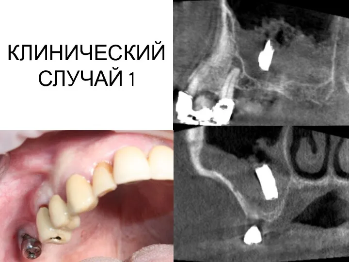 КЛИНИЧЕСКИЙ СЛУЧАЙ 1