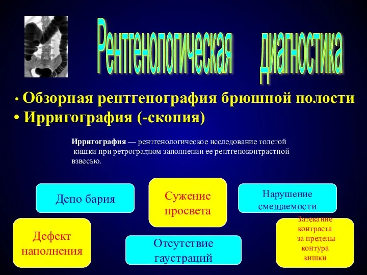 Рентгенологическая диагностика Обзорная рентгенография брюшной полости Ирригография (-скопия) Ирригография — рентгенологическое исследование