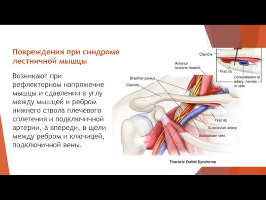 Возникают при рефлекторном напряжение мышцы и сдавлении в углу между мышцей и