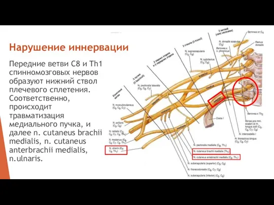 Передние ветви C8 и Th1 спинномозговых нервов образуют нижний ствол плечевого сплетения.