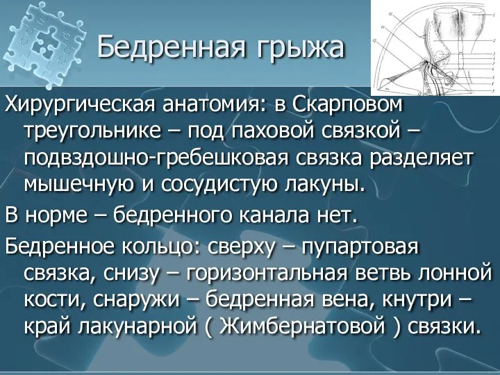 Бедренная грыжа Хирургическая анатомия: в Скарповом треугольнике – под паховой связкой –