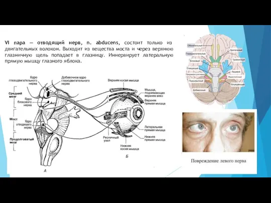 VI пара — отводящий нерв, n. abducens, состоит только из двигательных волокон.