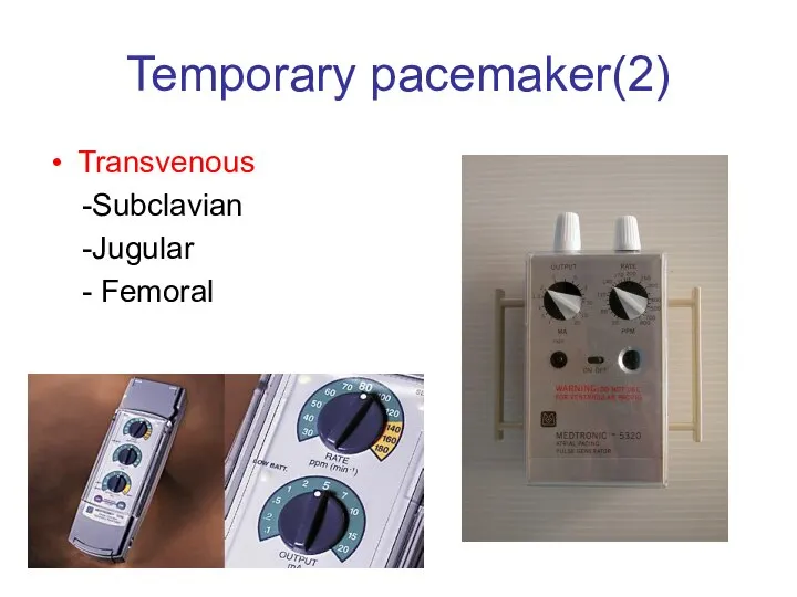 Temporary pacemaker(2) Transvenous -Subclavian -Jugular - Femoral