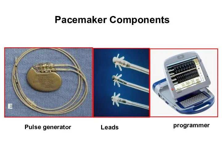 Pacemaker Components Pulse generator Leads programmer