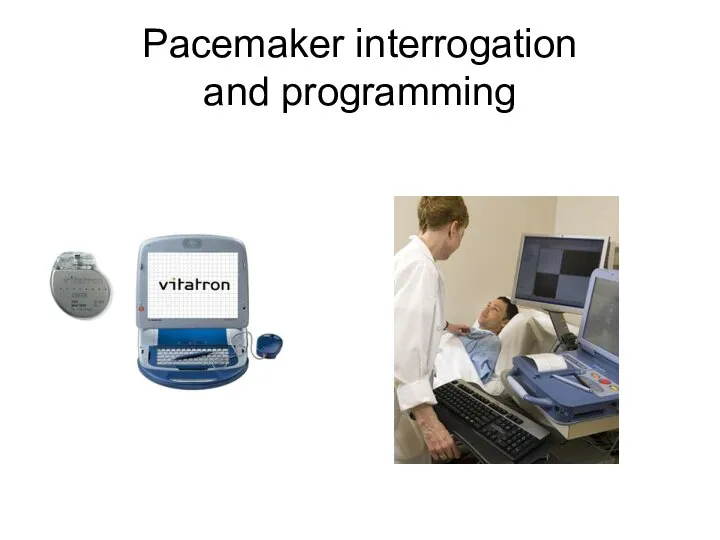 Pacemaker interrogation and programming