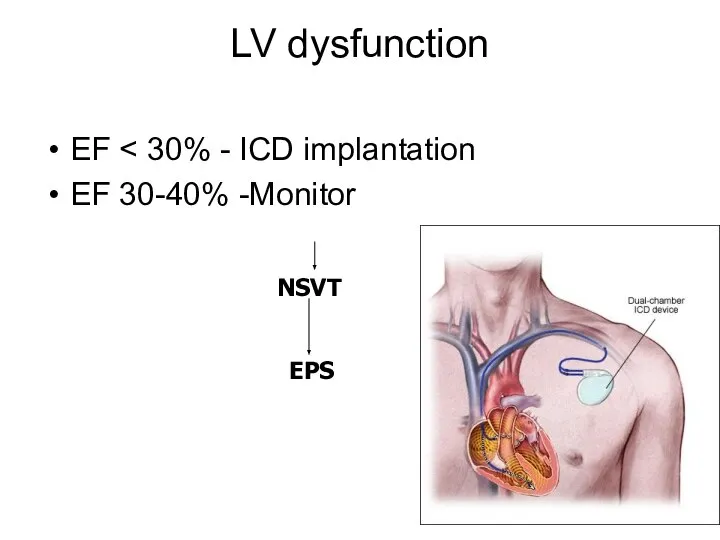 LV dysfunction EF EF 30-40% -Monitor NSVT EPS