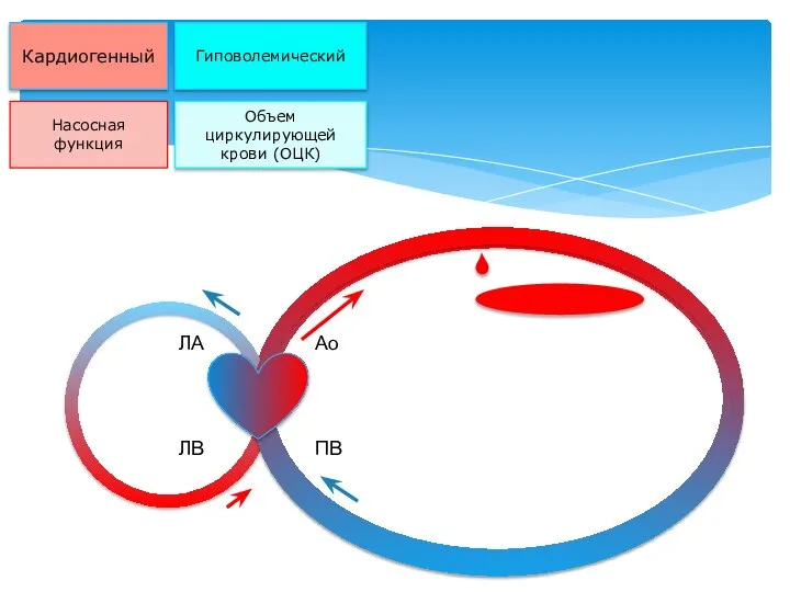 Кардиогенный Гиповолемический Насосная функция Объем циркулирующей крови (ОЦК) Ао ПВ ЛА ЛВ