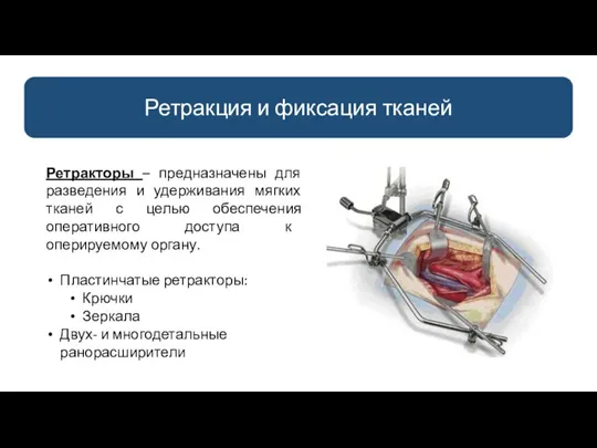 Ретракция и фиксация тканей Ретракторы – предназначены для разведения и удерживания мягких