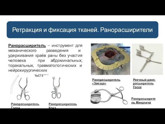 Ретракция и фиксация тканей. Ранорасширители Ранорасширитель – инструмент для механического разведения и