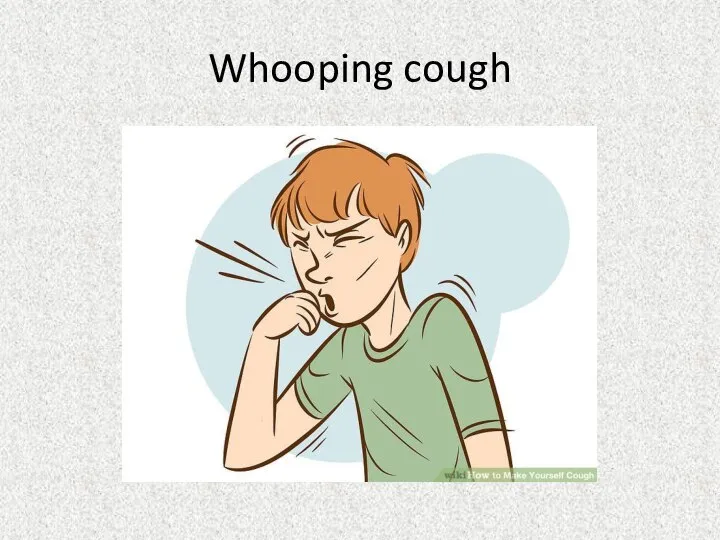 Whooping cough