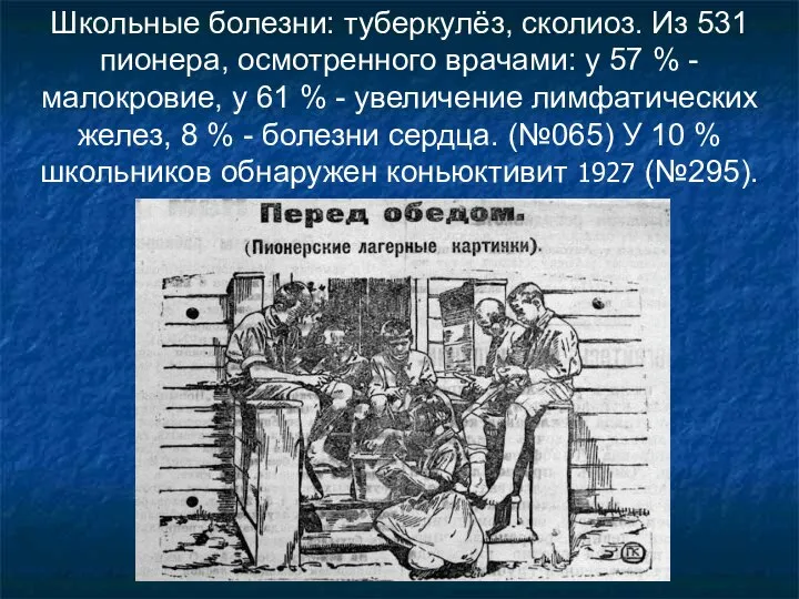 Школьные болезни: туберкулёз, сколиоз. Из 531 пионера, осмотренного врачами: у 57 %