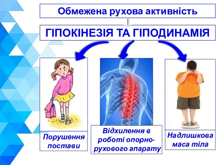 ГІПОКІНЕЗІЯ ТА ГІПОДИНАМІЯ Відхилення в роботі опорно-рухового апарату Порушення постави Надлишкова маса тіла Обмежена рухова активність