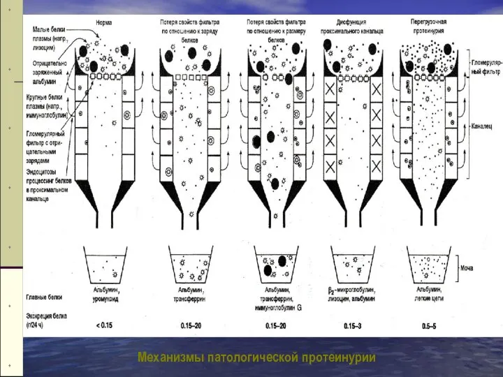 Механизмы патологической протеинурии