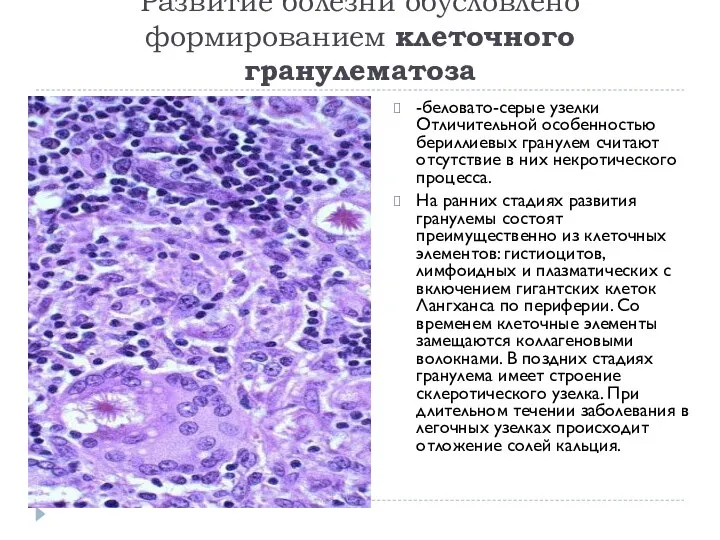 Развитие болезни обусловлено формированием клеточного гранулематоза -беловато-серые узелки Отличительной особенностью бериллиевых гранулем