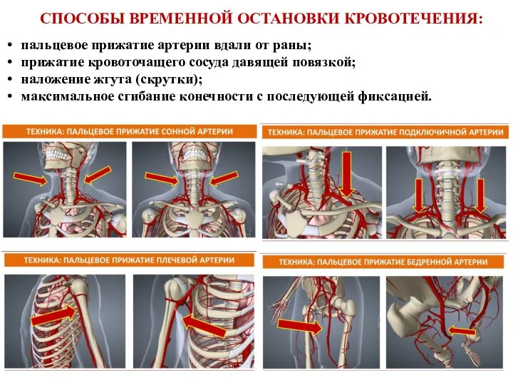 пальцевое прижатие артерии вдали от раны; прижатие кровоточащего сосуда давящей повязкой; наложение