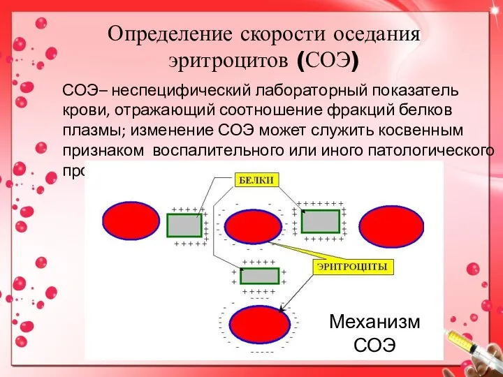 Определение скорости оседания эритроцитов (СОЭ) СОЭ– неспецифический лабораторный показатель крови, отражающий соотношение