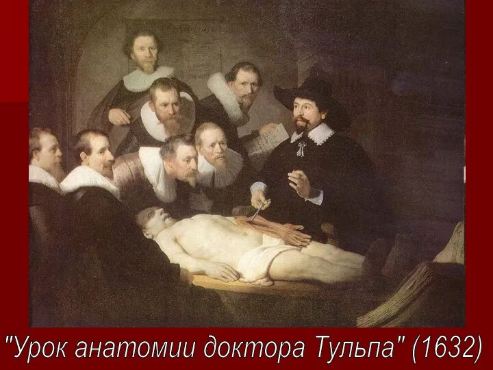 "Урок анатомии доктора Тульпа" (1632)