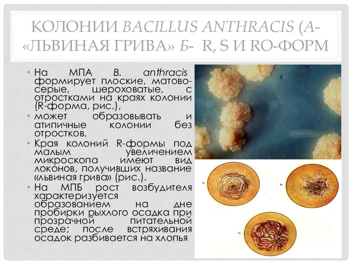 KОЛОНИИ BACILLUS ANTHRACIS (A-«ЛЬВИНАЯ ГРИВА» Б- R, S И RO-ФОРМ На МПА