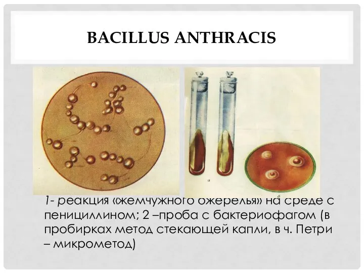 BACILLUS ANTHRACIS 1- реакция «жемчужного ожерелья» на среде с пенициллином; 2 –проба