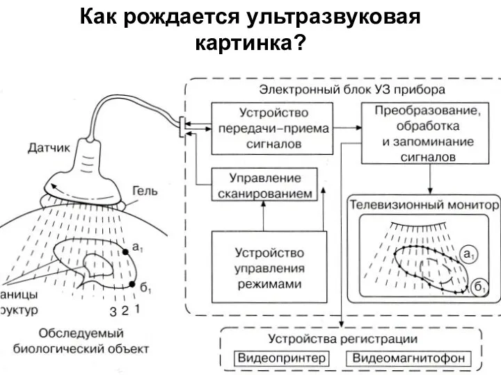 Как рождается ультразвуковая картинка?