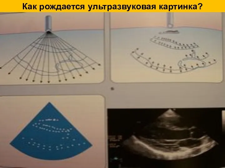 Как рождается ультразвуковая картинка?