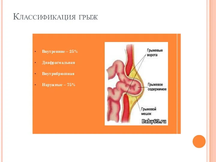 Классификация грыж