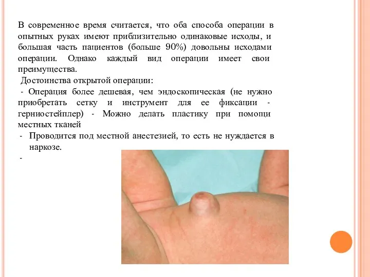 В современное время считается, что оба способа операции в опытных руках имеют