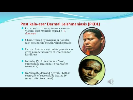 Post kala-azar Dermal Leishmaniasis (PKDL) Occurs after recovery in some cases of
