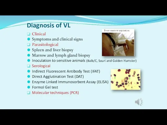Diagnosis of VL Clinical Symptoms and clinical signs Parasitological Spleen and liver