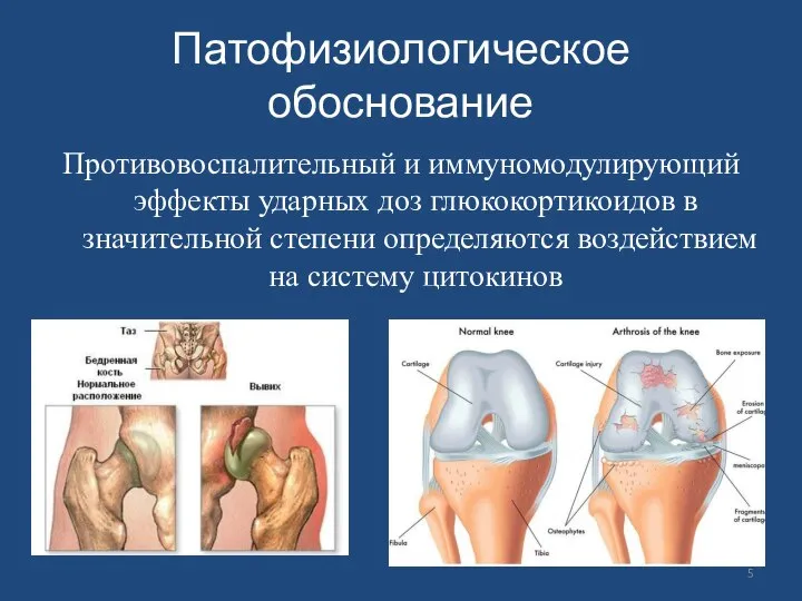 Патофизиологическое обоснование Противовоспалительный и иммуномодулирующий эффекты ударных доз глюкокортикоидов в значительной степени