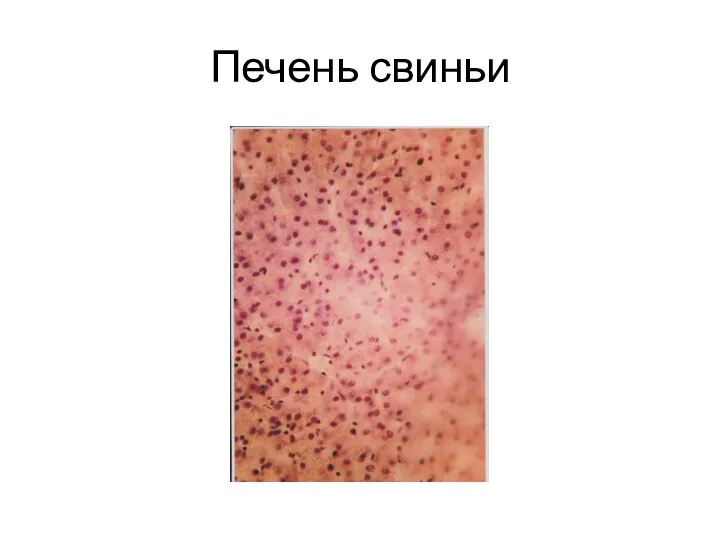 Печень свиньи