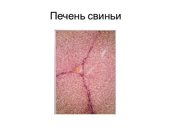 Печень свиньи