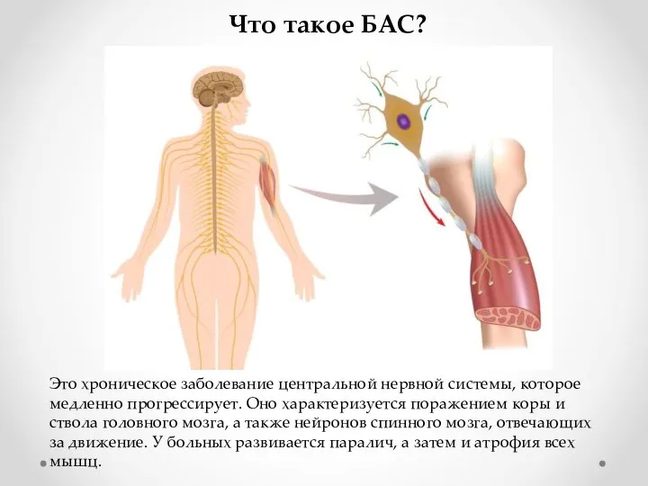 Что такое БАС? Это хроническое заболевание центральной нервной системы, которое медленно прогрессирует.
