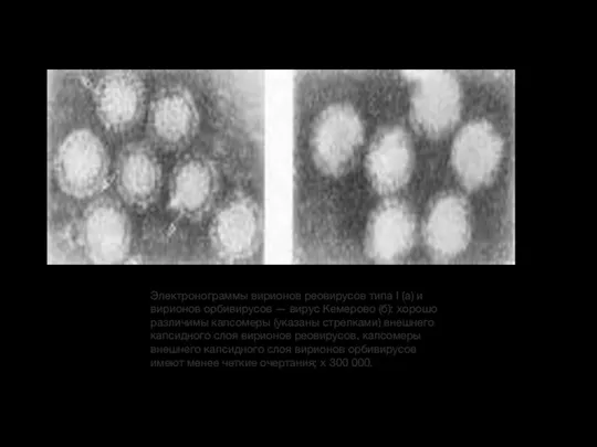 Электронограммы вирионов реовирусов типа I (а) и вирионов орбивирусов — вирус Кемерово