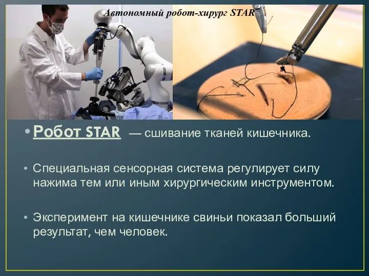 Робот STAR — сшивание тканей кишечника. Специальная сенсорная система регулирует силу нажима