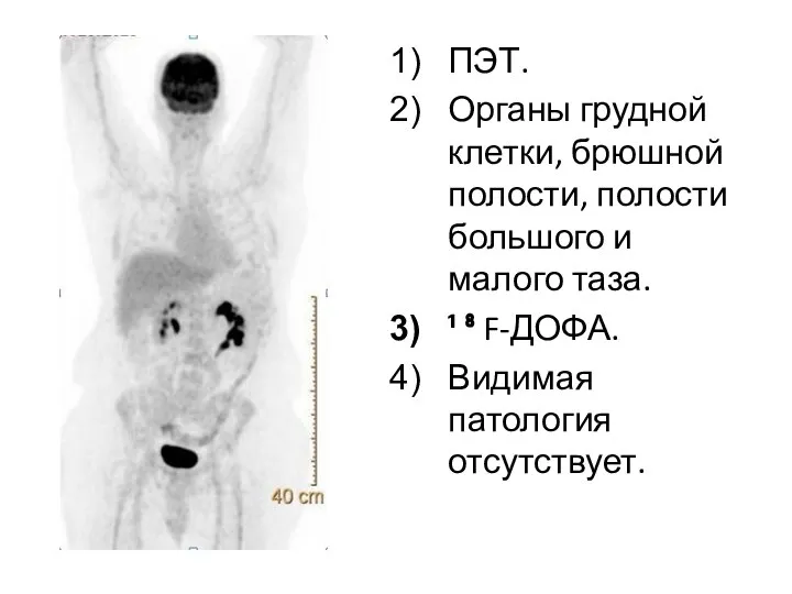 ПЭТ. Органы грудной клетки, брюшной полости, полости большого и малого таза. ¹