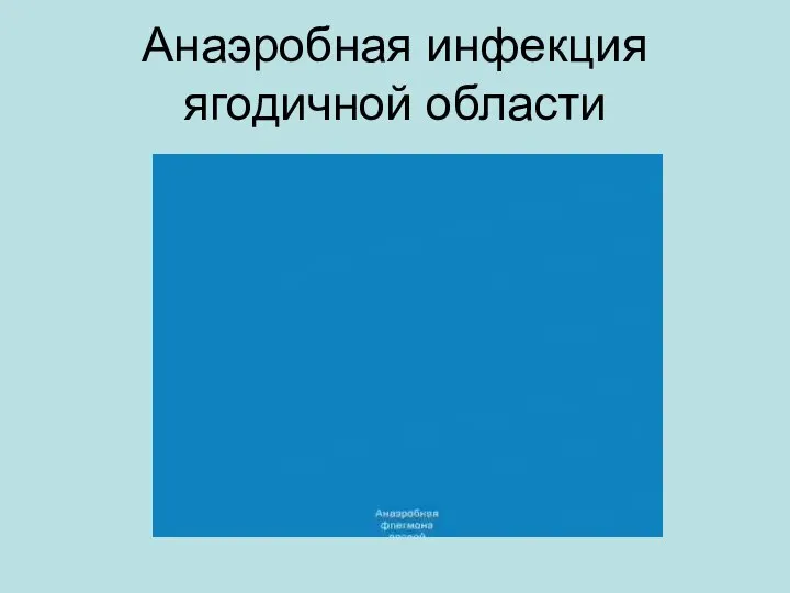 Анаэробная инфекция ягодичной области