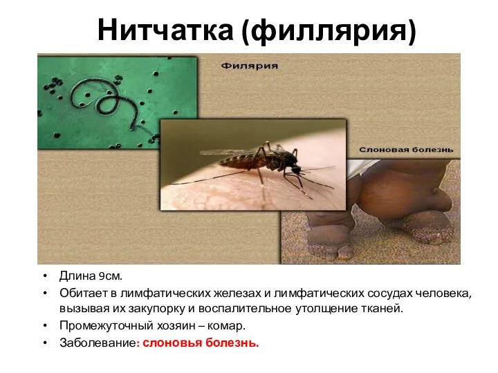 Нитчатка (филлярия) Длина 9см. Обитает в лимфатических железах и лимфатических сосудах человека,