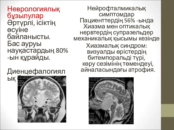 Неврологиялық бұзылулар Әртүрлі, ісіктің өсуіне байланысты. Бас ауруы науқастардың 80% -ын құрайды.