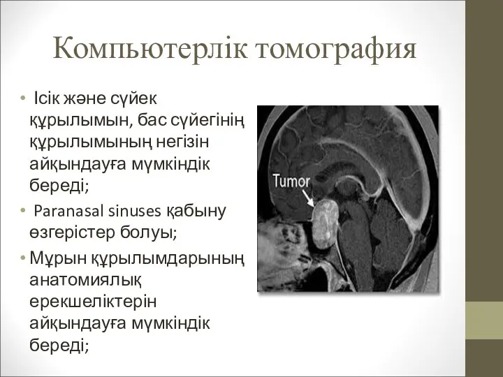 Компьютерлік томография Ісік және сүйек құрылымын, бас сүйегінің құрылымының негізін айқындауға мүмкіндік