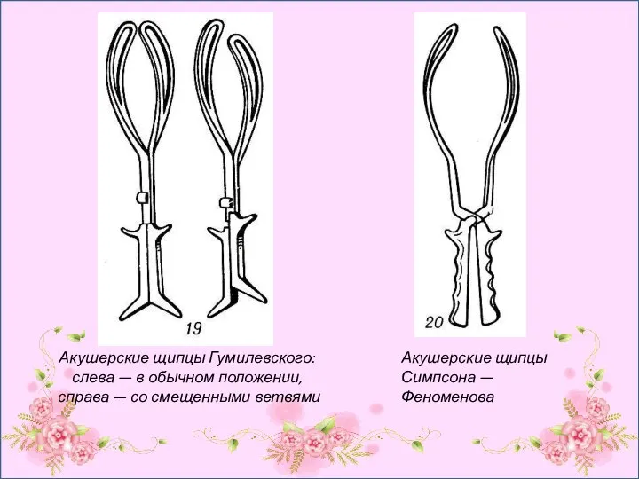 Акушерские щипцы Гумилевского: слева — в обычном положении, справа — со смещенными