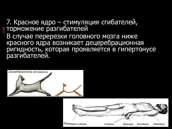 7. Красное ядро – стимуляция сгибателей, торможение разгибателей В случае перерезки головного