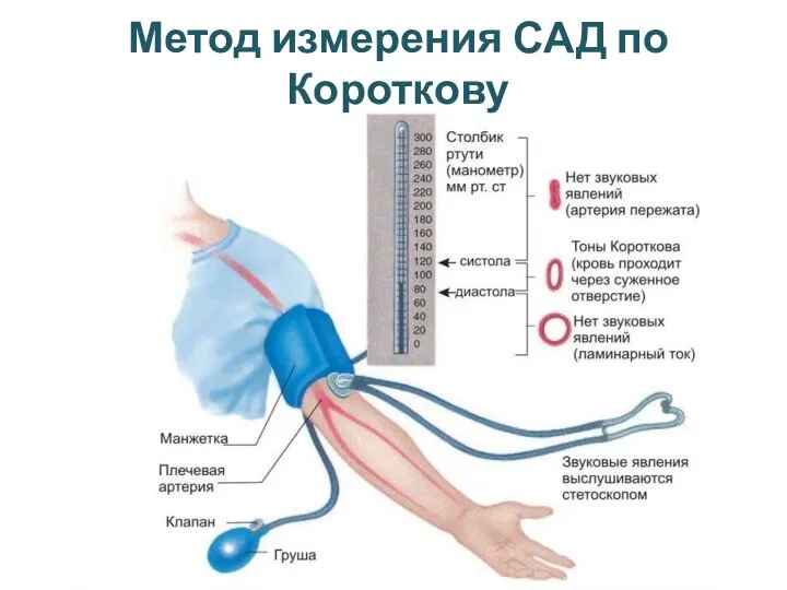 Метод измерения САД по Короткову