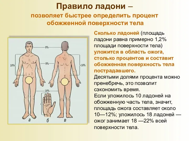 Сколько ладоней (площадь ладони равна примерно 1,2% площади поверхности тела) уложится в