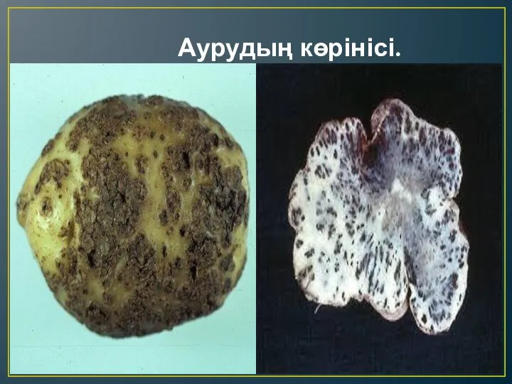 Аурудың көрінісі.