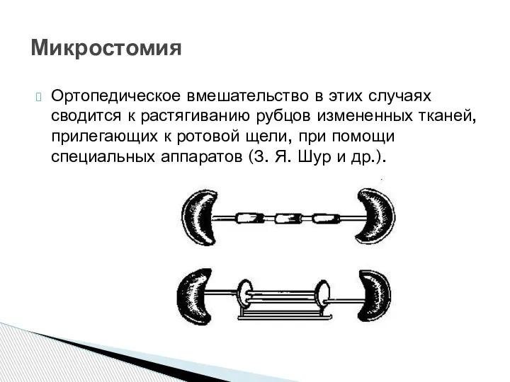 Ортопедическое вмешательство в этих случаях сводится к растягиванию рубцов измененных тканей, прилегающих