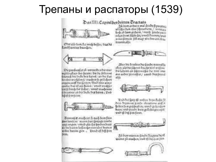 Трепаны и распаторы (1539)